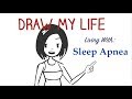 Draw my life: living with sleep apnea