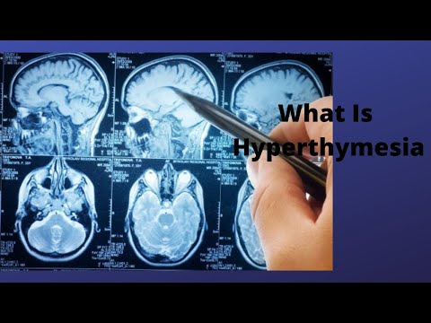 What is Hyperthymesia?