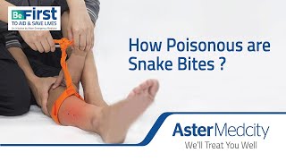 How Poisonous Are Snake Bites?