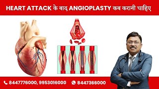 Heart Attack के बाद Angioplasty कब करानी चाहिए ? | Dr. Bimal Chhajer | SAAOL