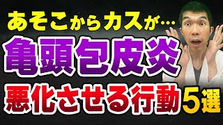 【男性必見！】亀頭包皮炎 を悪化させる行動5選【原因、症状、治療法、予防法】を現役泌尿器科医が解説