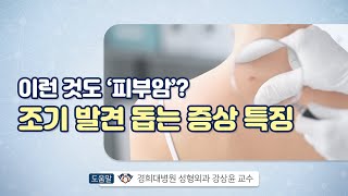 이런 것도 ‘피부암’? 조기 발견 돕는 증상 특징