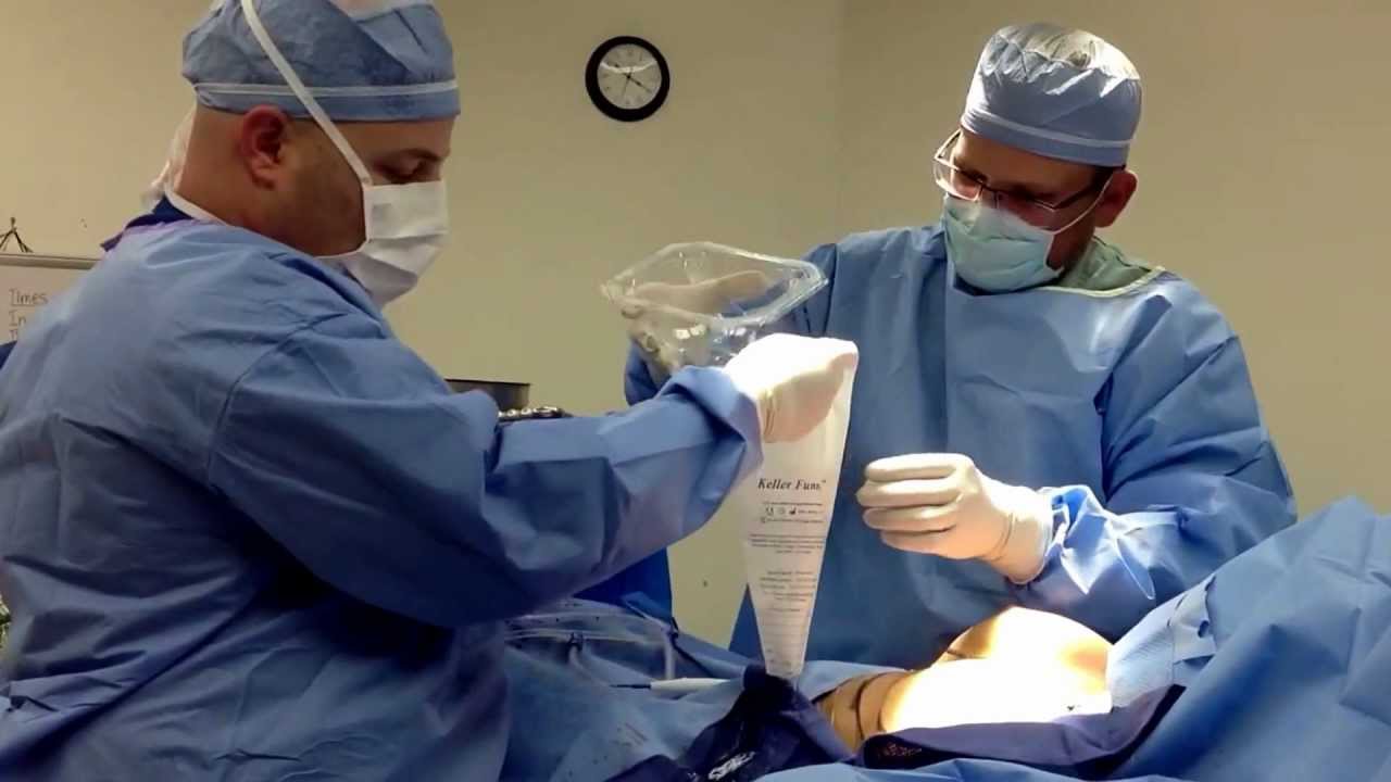 Tampa Plastic Surgeon Breast Augmentation At Vitale Institutue - YouTube