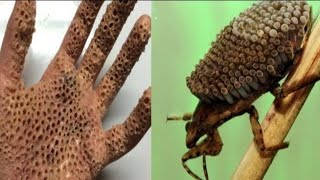 5 dangerous insects in the world #awesome list hindi