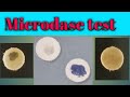 Microdase test: Biochemical test lecture 25