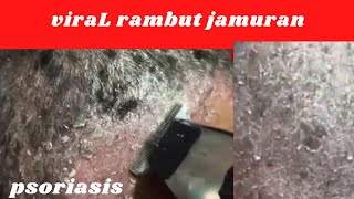 viral cukur rambut bersihin b0rok bersihin ketombe