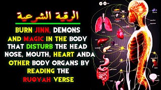 STRONG RUQYAH TO EXPEL JINN, MAGIC AND EVIL INSIDE MY BODY