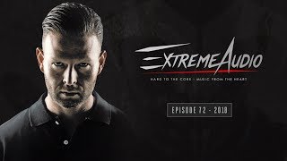 Extreme Audio Episode 72