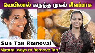 Easy natural tips for get rid of Sun Tan |எளிதாக சருமத்தில் இருக்கும் கருமையை நீக்க | Samayam Tamil