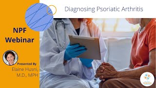 Diagnosing Psoriatic Arthritis