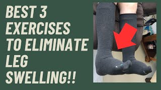 Edema? Swollen Feet? The Best three exercsises to eliminate swelling!