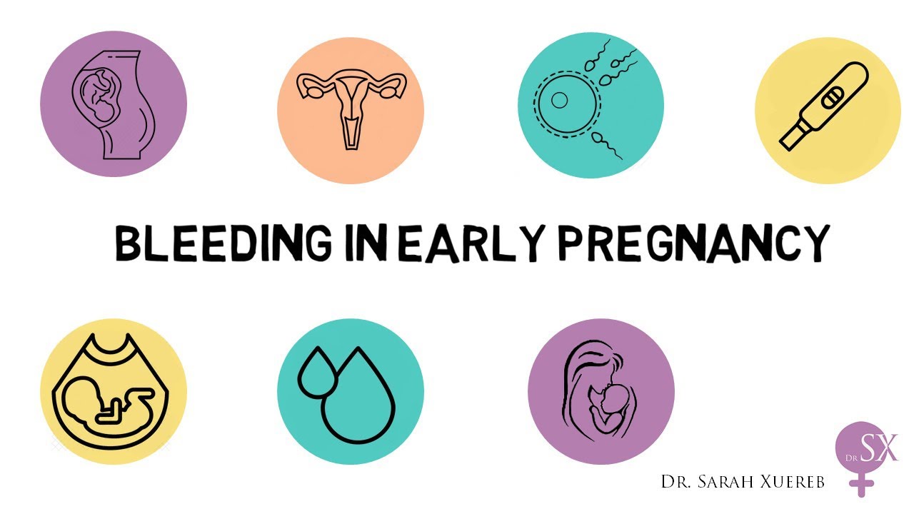 Bleeding In Early Pregnancy - YouTube