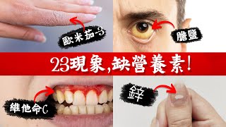 23種症狀,告訴你缺的營養素,柏格醫生 Dr Berg