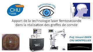 Apport du laser femtoseconde dans les greffes lamellaires antérieures profondes