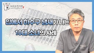 특별한 증상 없이 입에서 하수구 냄새가 나는 10대 소녀.. 어떻게 치료할 수 있을까?!