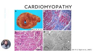 Danon Disease