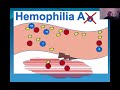 Video 1 - What is Hemophilia?