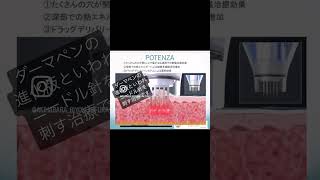 ポテンツア（POTENZA）にマックームはあり？なし？