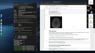 bart webinar 4 - hands-on tutorial