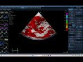 iq 150 TSI LV,   ECHOPAC ANALYSIS, ECHOCARDIOGRAPHY, SMALL ANIMAL