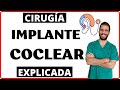 IMPLANTE COCLEAR 🦻 ¿Cómo es la cirugía?