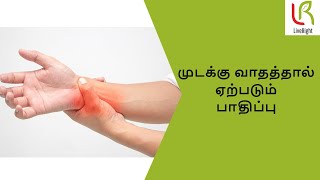 முடக்கு வாதத்தால் ஏற்படும் பாதிப்பு | Rheumatoid arthritis | Dr. A. Radhakrishna |LiveRight Ayurveda