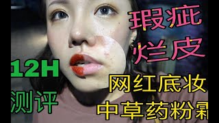 瑕疵皮/痘肌烂皮的网红底妆12小时测评 | 吃喝玩乐vlog