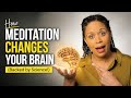 Is Your Brain Stuck in Stress? How Meditation Changes the Amygdala