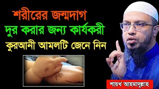 শরীরের জন্মদাগ দুর করার কার্যকরী কুরআনী আমল |Shaikh Ahmadullah|শায়খ আহমাদুল্লাহ