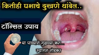 टॉन्सिल दुखणे लगेच थांबवा,या पाण्याने गुळण्या करा;स्वागत तोडकर. Relief from tonsils instantly