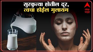 Milk Hacks : कच्च्या दुधाचा असा करा वापर, सुरकुत्या होतील दूर