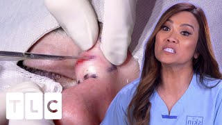 "A Moment Of Imprecision And I Can Really Mess Up This Guy's Face" | Dr. Pimple Popper