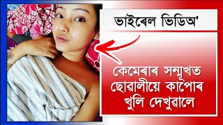 কেমেৰাৰ সন্মূখত ছোৱালীয়ে কাপোৰ খুলিলে😱 || Assamese Virel Video Roast || Nagaon Roaster Boy