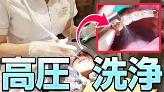 気になる着色汚れを一掃！エアフローで徹底掃除！【歯のクリーニング】