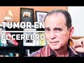 Episodio #1246 Tumor En El Cerebro