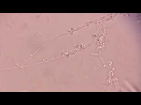 How is Chlamydospores formed?