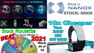 What is Nanox Imaging Stock? Is NNOX stock a buy now?  Week 40 of 52 of Stock Roulette.