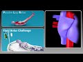 Cheetah Medical Dynamic Assessments Animation