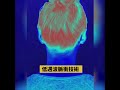 骨科醫生推薦使用【3d恆溫熱敷理療】護頸 熱敷 6種按摩，告別頸椎問題 精選下殺7折