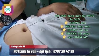 Chí Phí Cắt Bao Quy Đầu Bằng Máy Trọn Gói Tại Phòng Khám 99 | PK99 - BS BV BÌNH DÂN