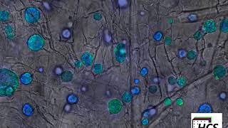 HCT116 cells in BIOMIMESYS (confocal microscopy)