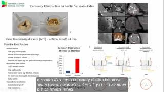 TAVI valve in valve: A shifting paradigm in treating failed bioprosthetic valves | Ran Kornowski