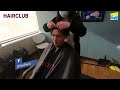 non surgical hair replacement loss hair in 30 s head reveal tim pacis