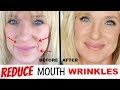 Get RID Of MOUTH WRINKLES! WithOUT Fillers! Get RID Of MOUTH WRINKLES! WithOUT Fillers!