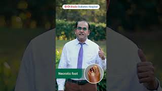 PART 2 - Various Stages of Diabetic Foot | Dr. Jayanthinathan | Podiatry | Ahalia Diabetes Hospital