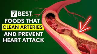 7 Amazing Foods that Clean Arteries and Prevent Heart Attack