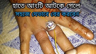 হাতে আটকে যাওয়া আংটি সহজে কিভাবে খুলবেন || How To Remove Finger Ring / Bhiral Media