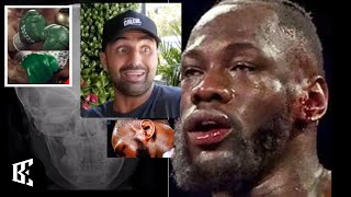 EVISCERATED: DEONTAY WILDER CANT BLAME "WH!TE PRIVILEGE" WHEN TYSON FURY SMOKË HIM AGAIN | BOXINGEGO