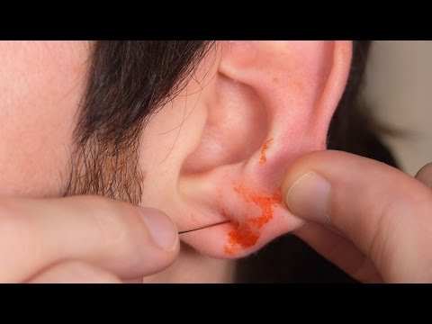 EAR PIERCING GONE WRONG! EAR PIERCING GONE WRONG!