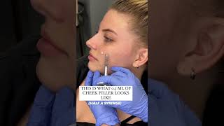 Demonstration of where cheek filler would be placed!! #cheekfiller #cheekfillers #contouredcheeks